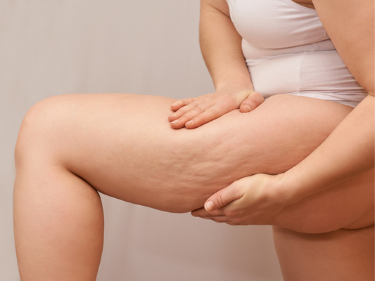 Getting Rid of Cellulite: Can Red Light Therapy Help?